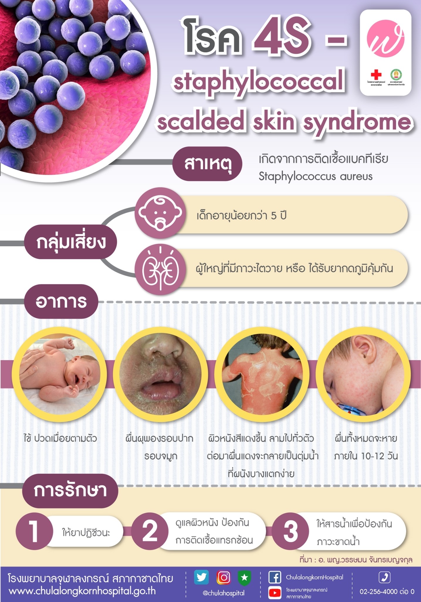 โรค 4S – staphylococcal scalded skin syndrome