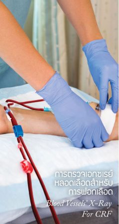 การตรวจเอกซเรย์หลอดเลือดสำหรับการฟอกเลือด