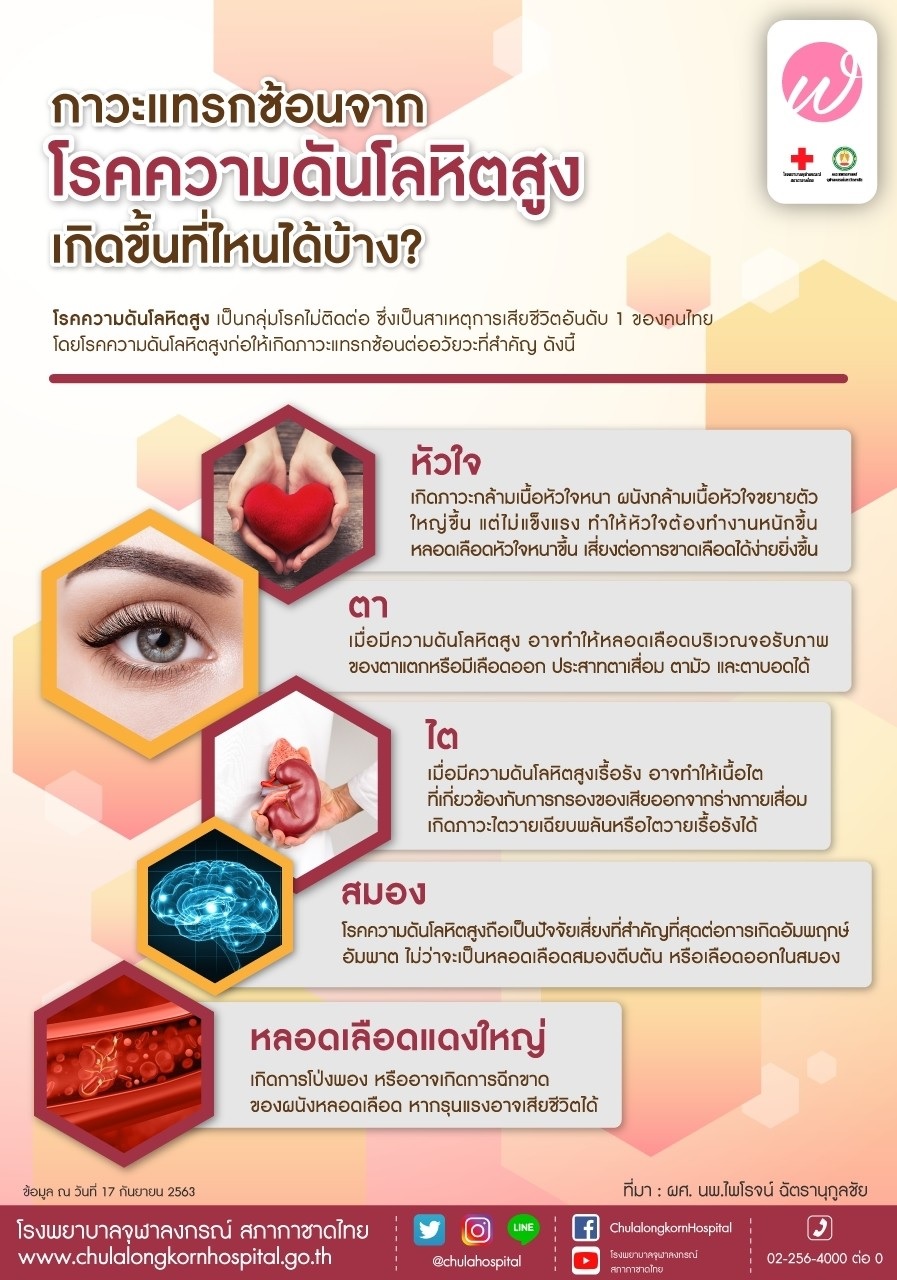 ภาวะแทรกซ้อนจากโรคความดันโลหิตสูง เกิดขึ้นที่ไหนได้บ้าง -  โรงพยาบาลจุฬาลงกรณ์ สภากาชาดไทย