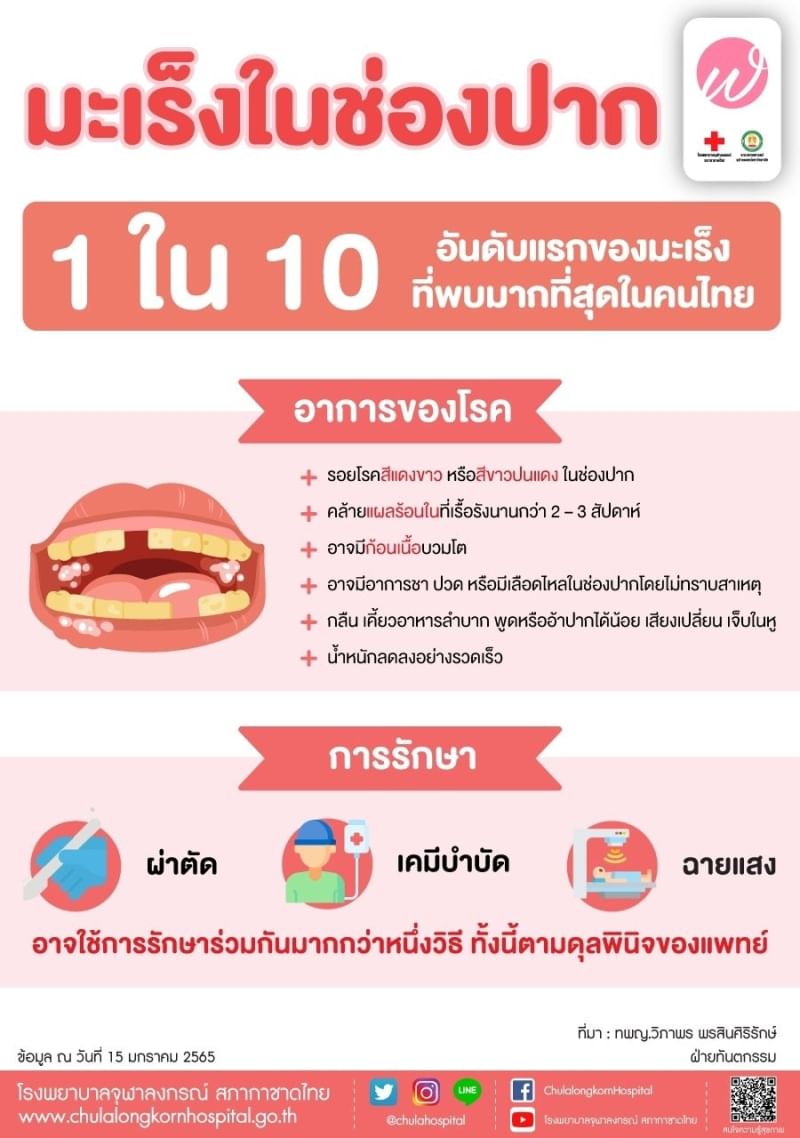 มะเร็งในช่องปาก 1 ใน 10 อันดับแรกของมะเร็ง ที่พบมากที่สุดในคนไทย