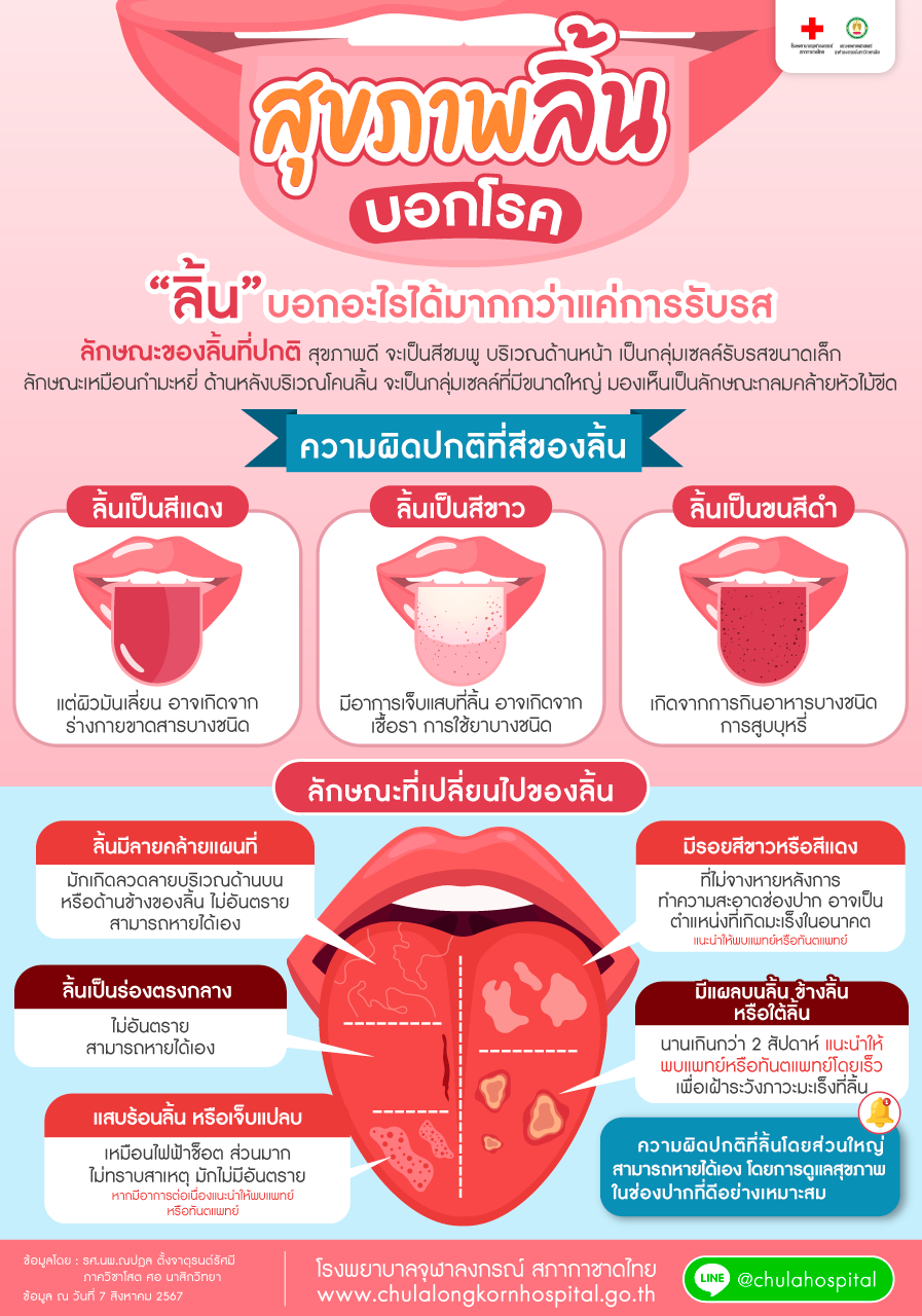 สุขภาพ “ลิ้น” บอกโรค