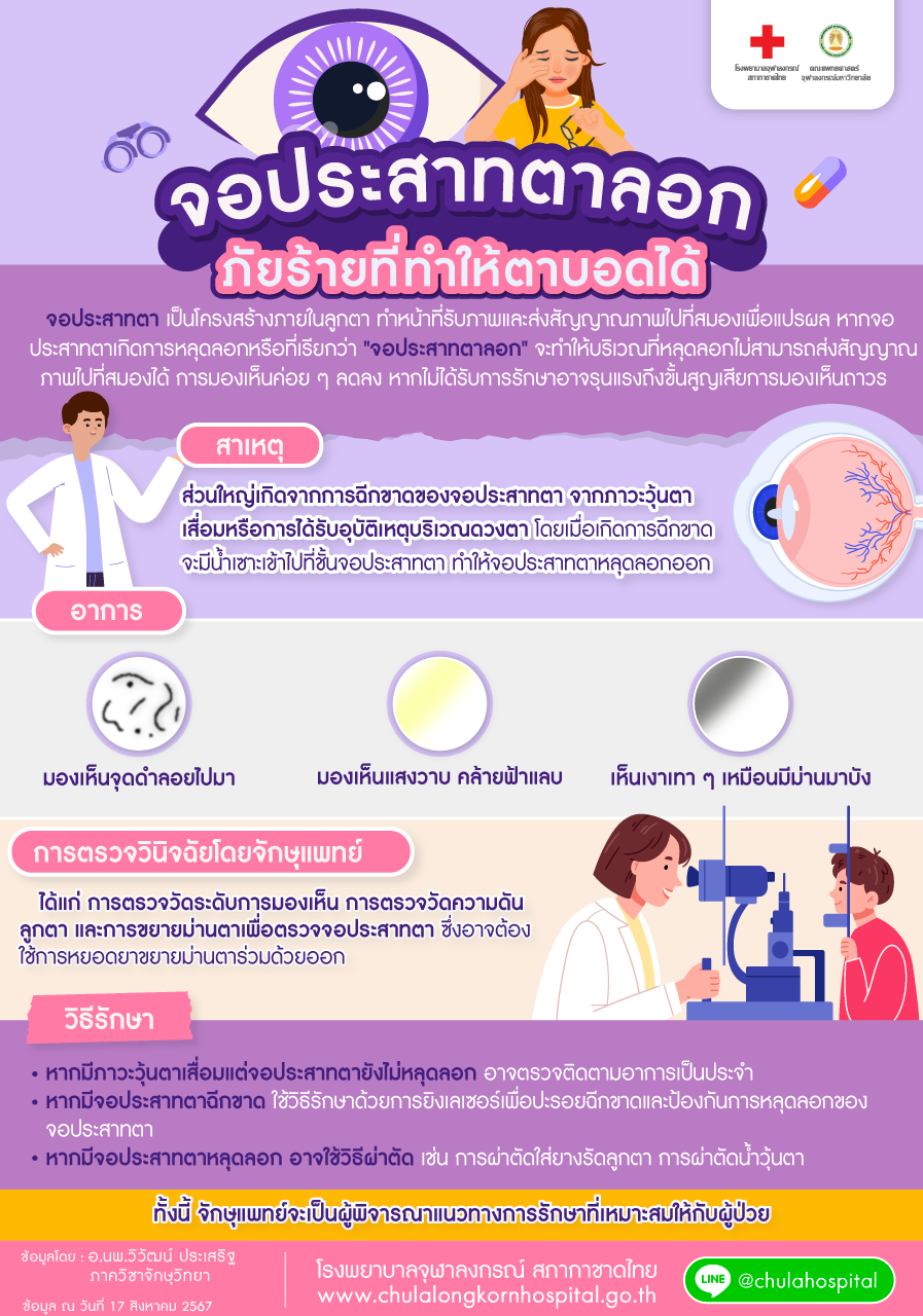 จอประสาทตาลอก ภัยร้ายที่ทำให้ตาบอดได้